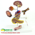 HEART22 (12555) Medical Anatomical Human Diabetes Model